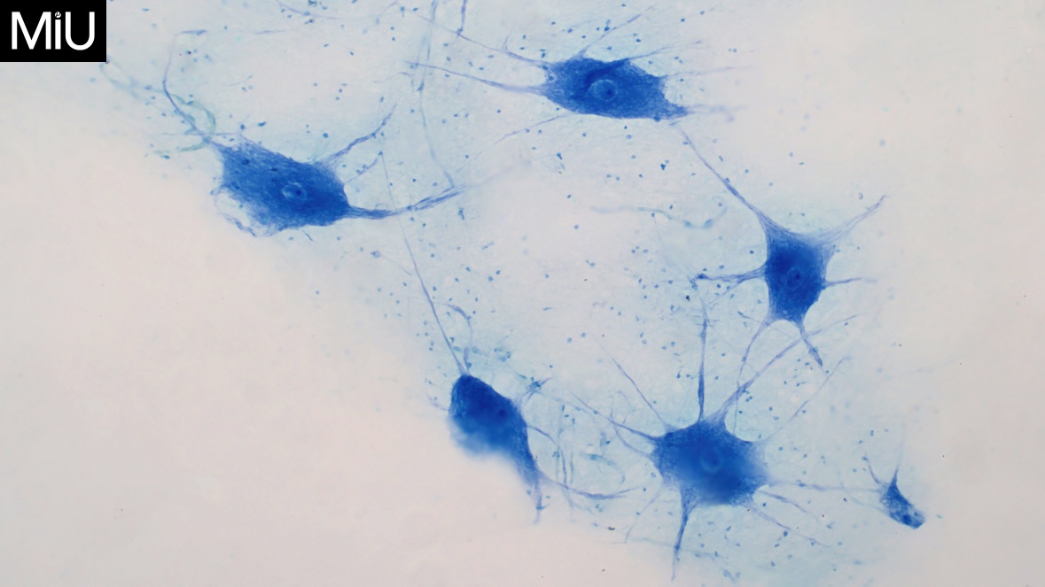 뇌세포 뉴런의 현미경 사진